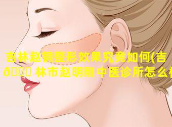 吉林赵钢整形效果究竟如何(吉 🐟 林市赵明刚中医诊所怎么样)